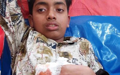 আতশবাজি তৈরী করতে গিয়ে আঙ্গুল খোয়ালেন কিশোর